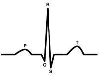 QT interval